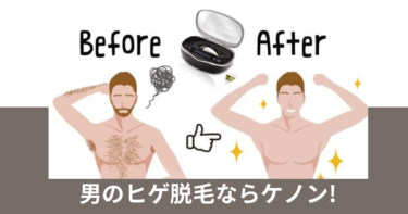 男のヒゲ脱毛ならケノン！ケノンのヒゲ脱毛に対する全てを徹底解説